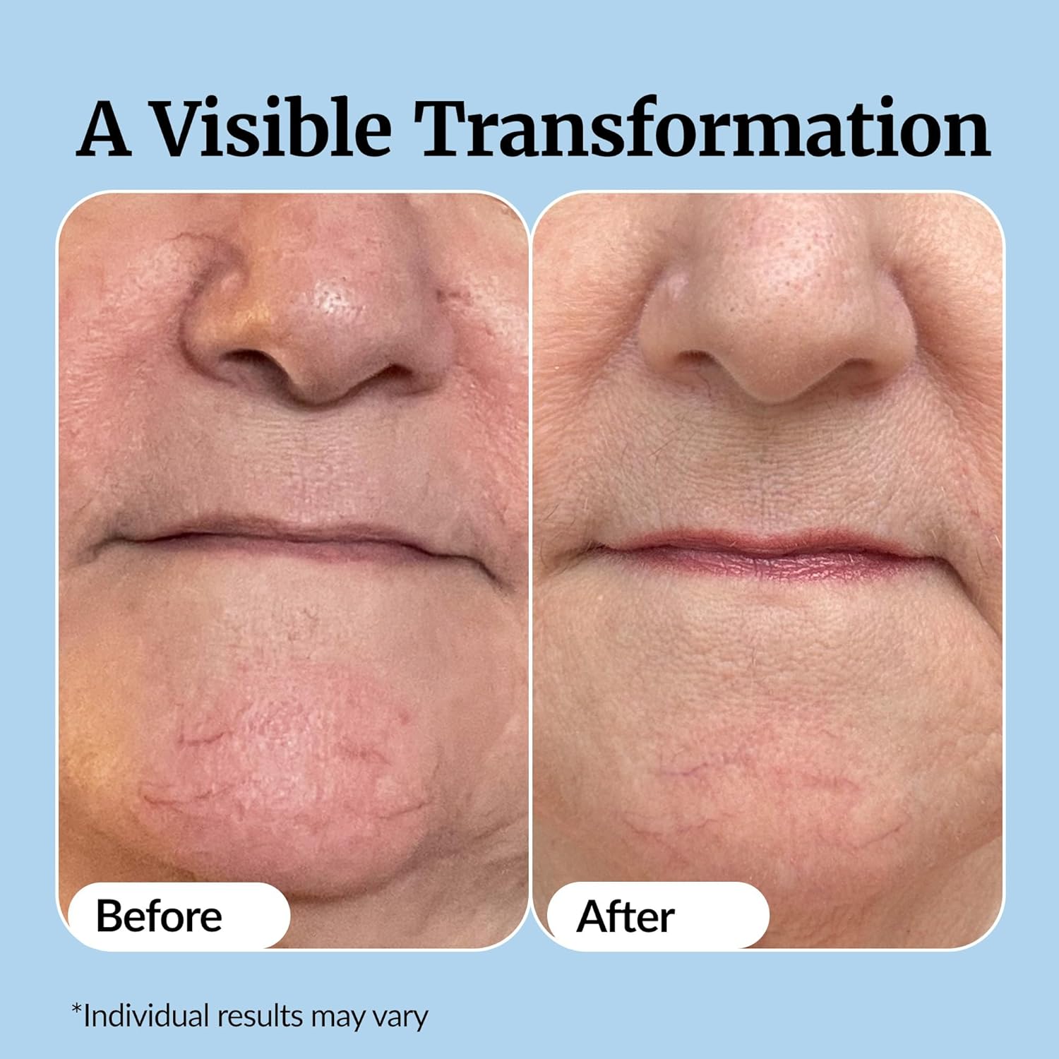 Radiant Glow Vitamin Serum